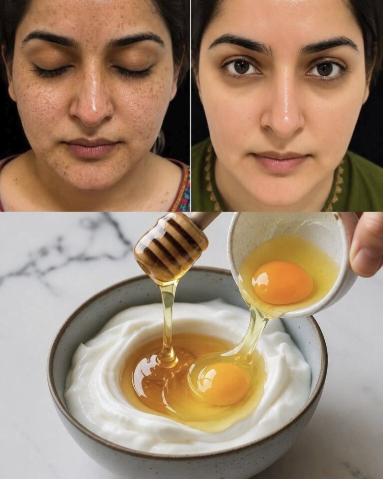 Îngrijirea tenului gras poate părea o provocare, dar nu trebuie să fie complicată. Cu ingredientele potrivite, precum oul și sucul de lămâie, poți transforma rutina ta de îngrijire a pielii într-un proces simplu și eficient. În acest articol, vom explora cum aceste ingrediente naturale pot contribui la obținerea unui ten strălucitor și sănătos, fără a recurge la produse chimice agresive.Testează Sucuri Naturale